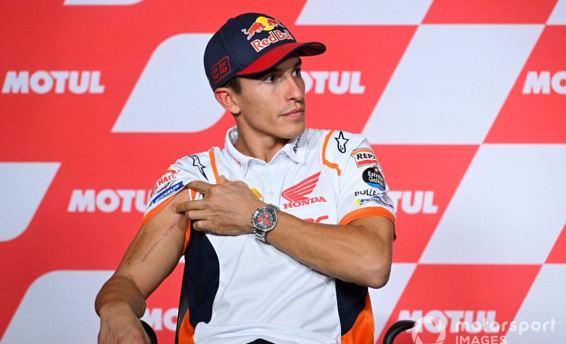 Marquez reveals his surgery scars after undergoing a fourth operation on his arm